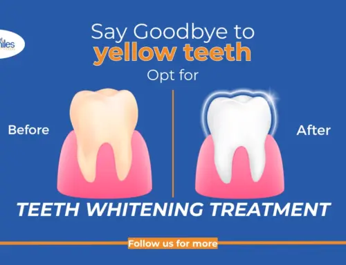 Say Goodbye to Yellow Teeth in Lake Worth, FL